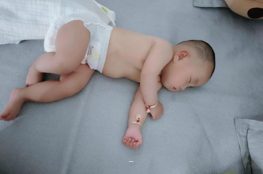 黔东孕妇肚脐周围发青